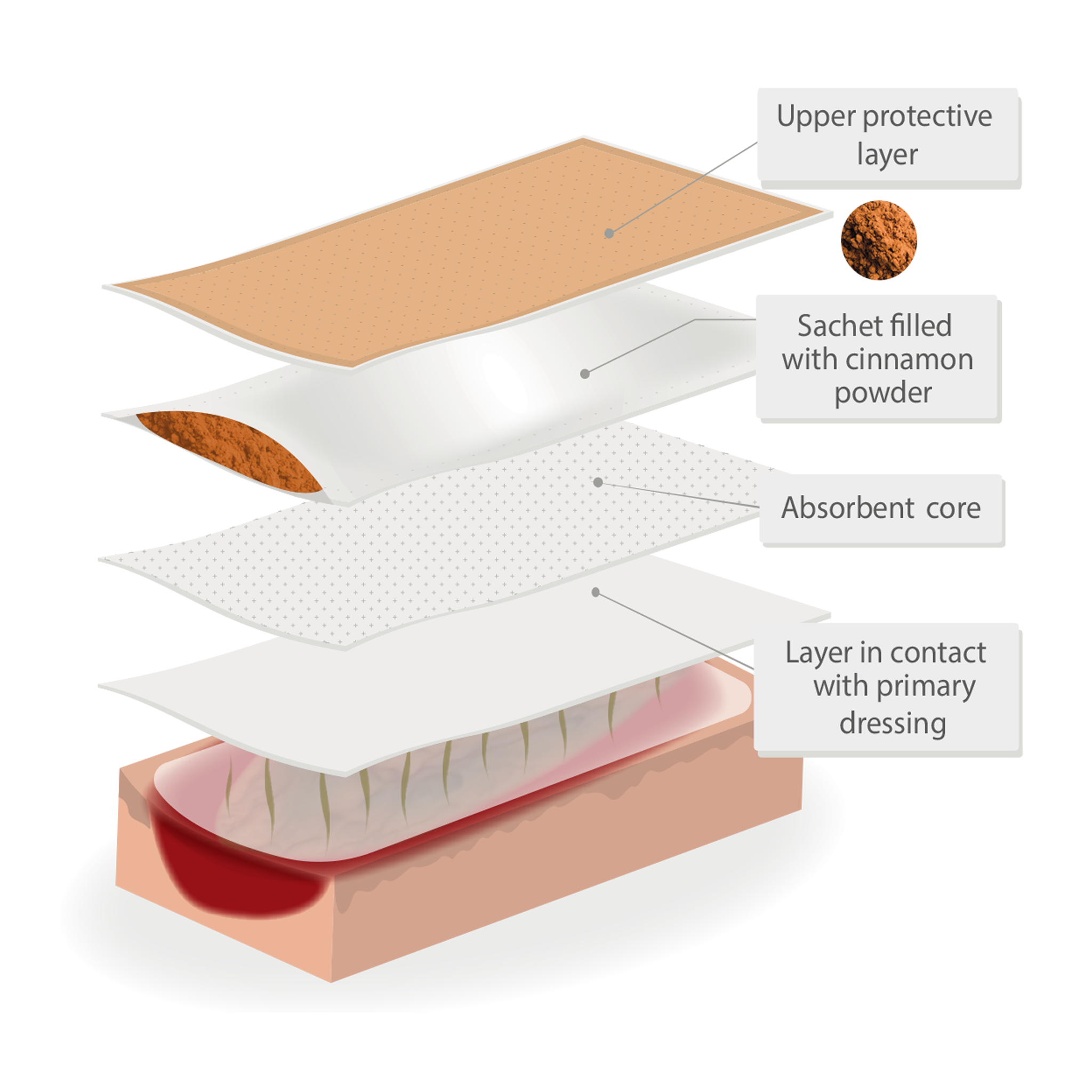 Cinesteam® Odour-reducing Secondary Wound Dressing - Pack of 12