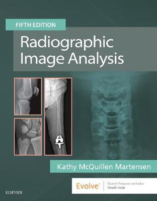 Radiographic Image analysis. Fourth Eddition